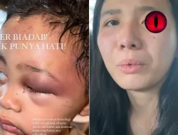 Viral! Anak Emy Aghnia Punjabi Selebgram Malang Babak Belur Disiksa Pengasuhnya