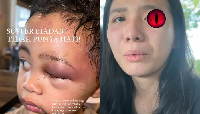 anak emy aghnia punjabi disiksa pengasuh