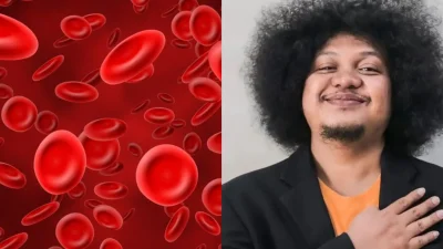 Apa itu Anemia Aplastik yang Diderita Babe Cabita?