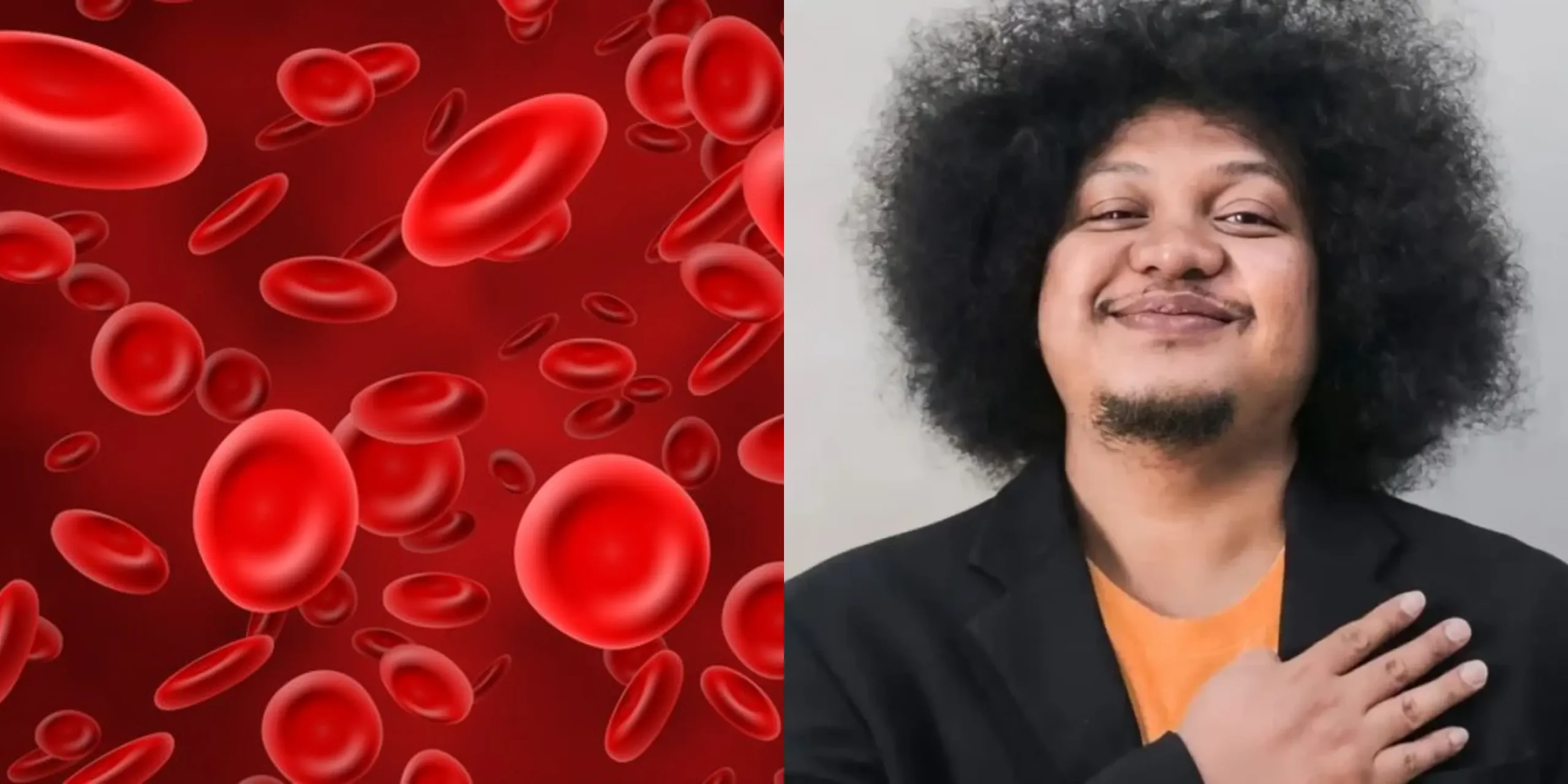 Apa itu Anemia Aplastik yang Diderita Babe Cabita?